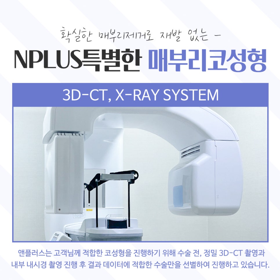 Learn About Hump Nose Surgery Reviews Accurately image 7