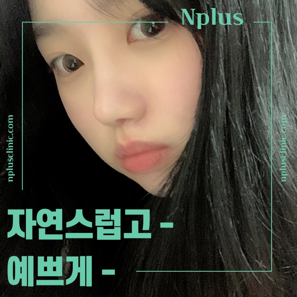 코성형후기 자연스러운 코라인으로 관련 이미지 4