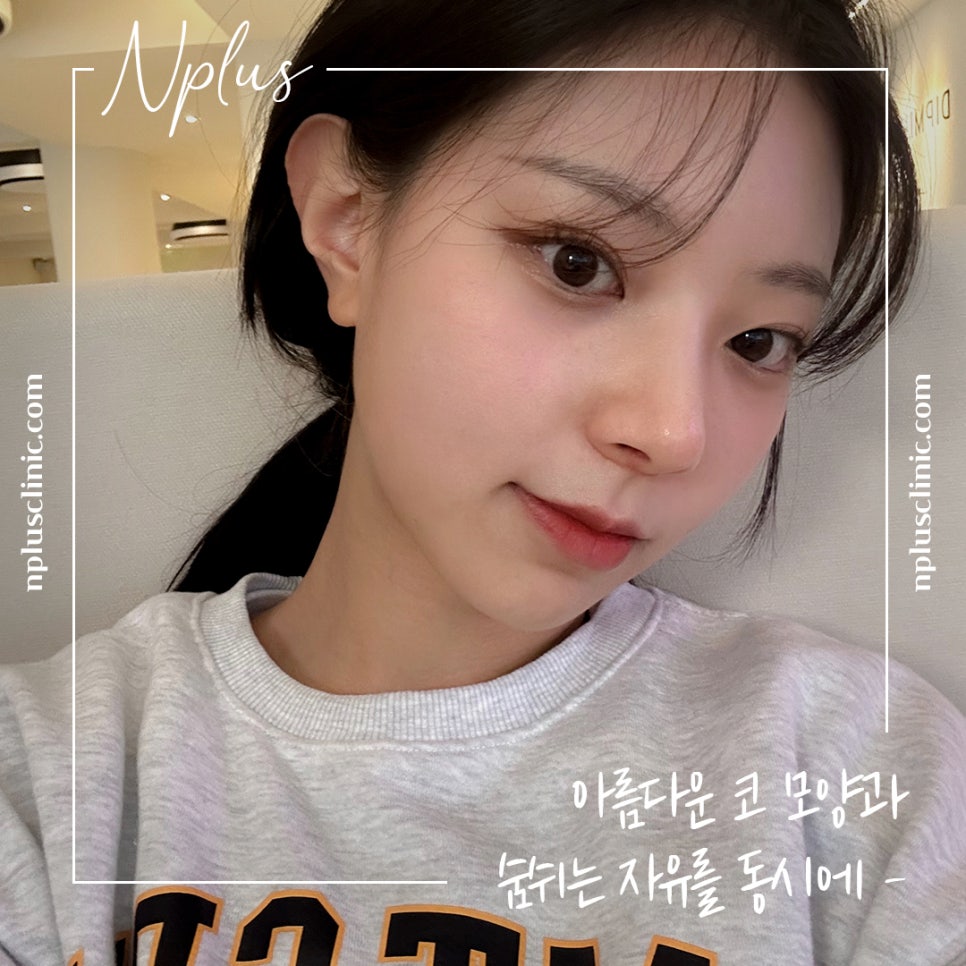 코수술후기를 통해 내게 어울리는 라인으로 관련 이미지 12
