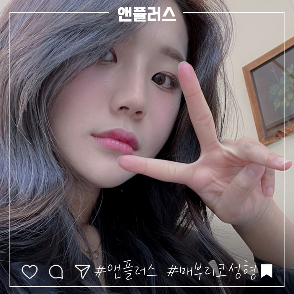 매부리코성형후기 정확한 진단을 통해 관련 이미지 1