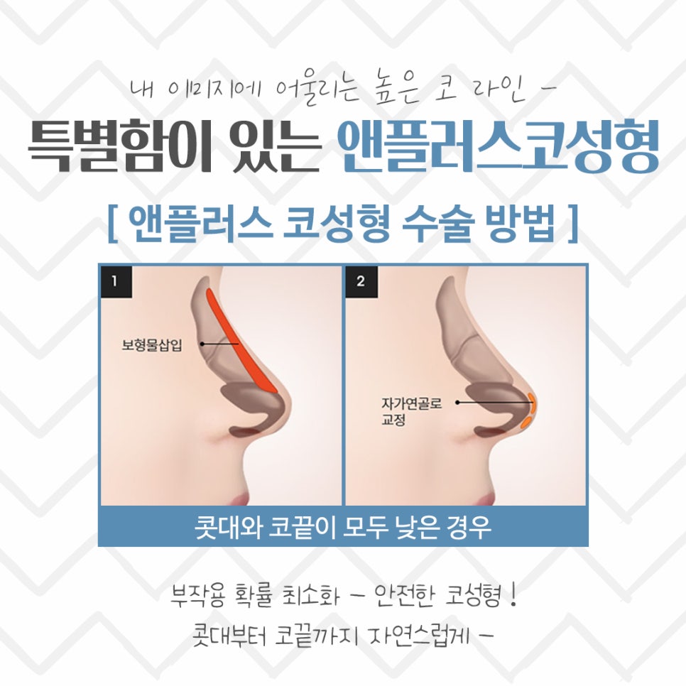 Nose Surgery Review: A Thorough Look Inside image 8
