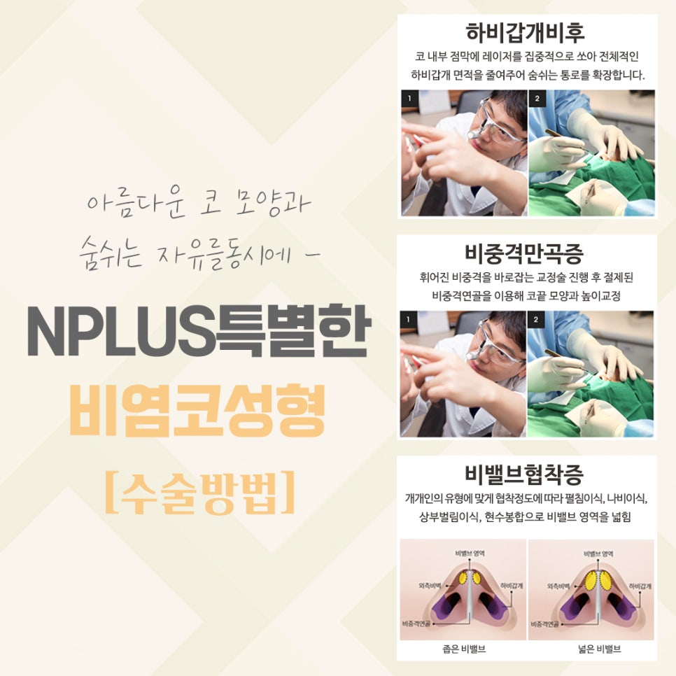 비염코수술후기를 잘 알아보고 관련 이미지 8