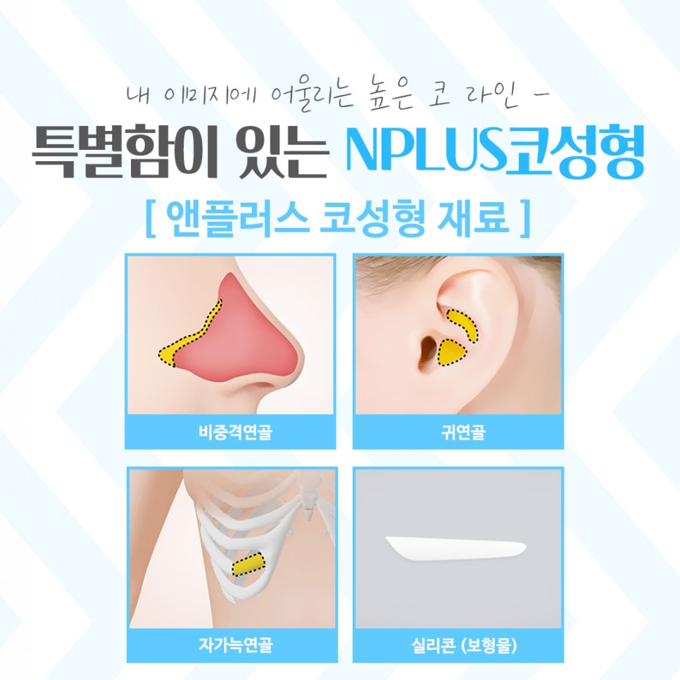 코성형잘하는곳에서 차이를 알아보고 관련 이미지 10