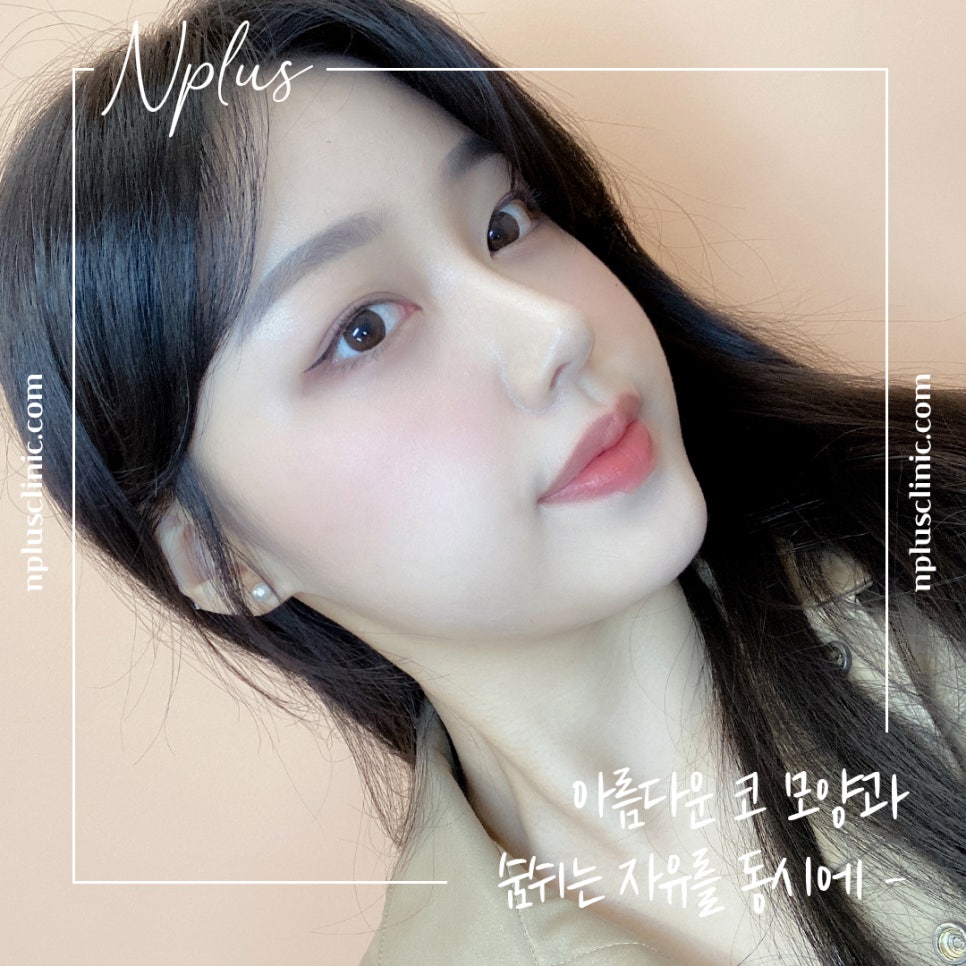 콧볼축소수술후기 내게 어울리는 라인으로 관련 이미지 4