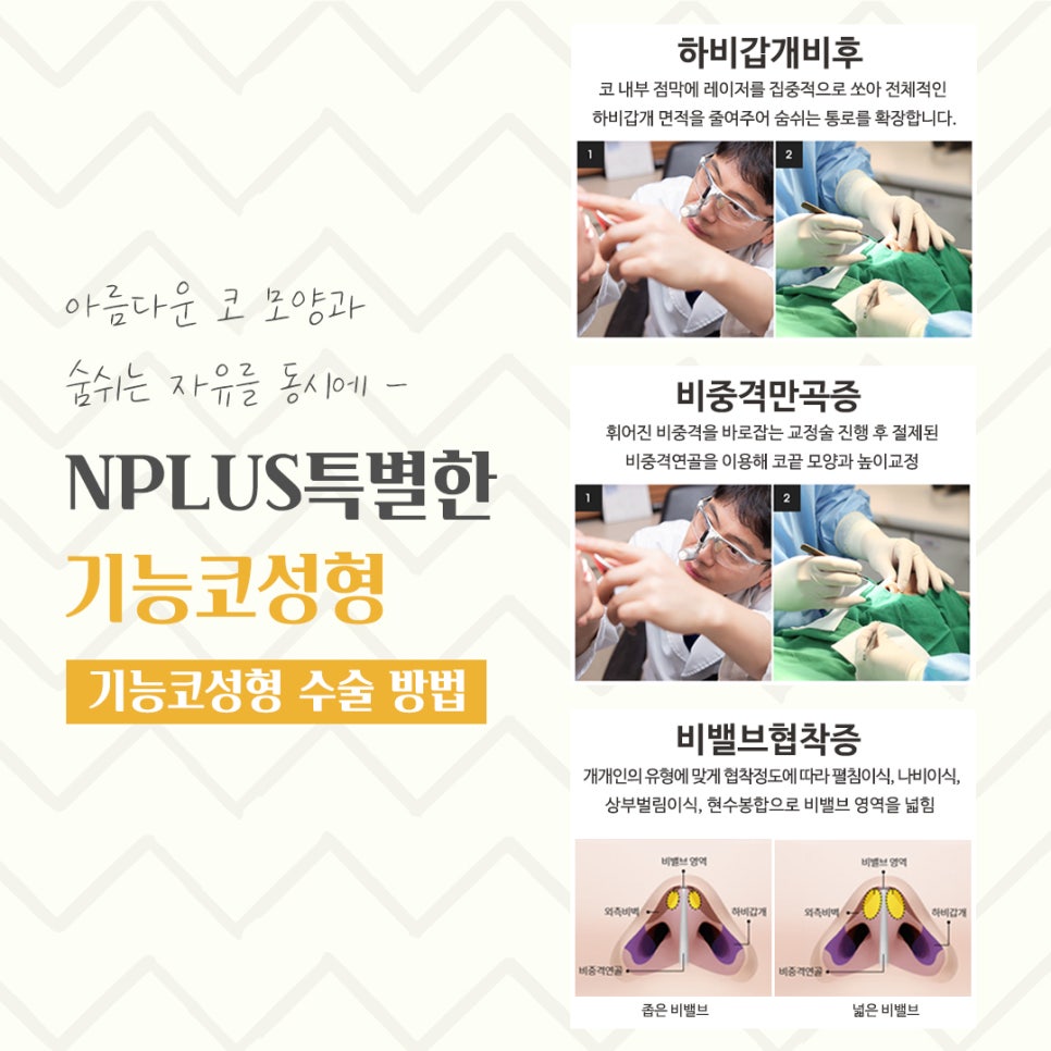 기능코성형후기 이미지를 고려하여 관련 이미지 9