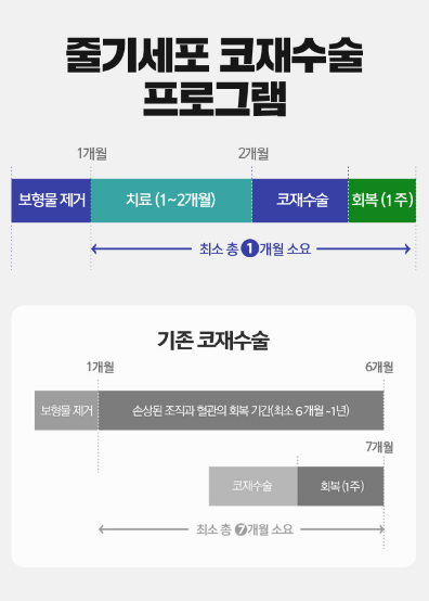 코재수술 1:1맞춤수술법 파헤치기 관련 이미지 6