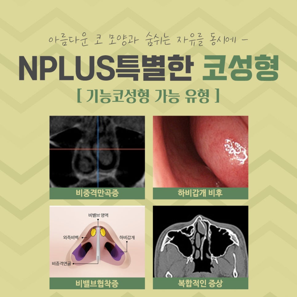 코성형전후 꼼꼼하게 비교하고 결정 관련 이미지 5