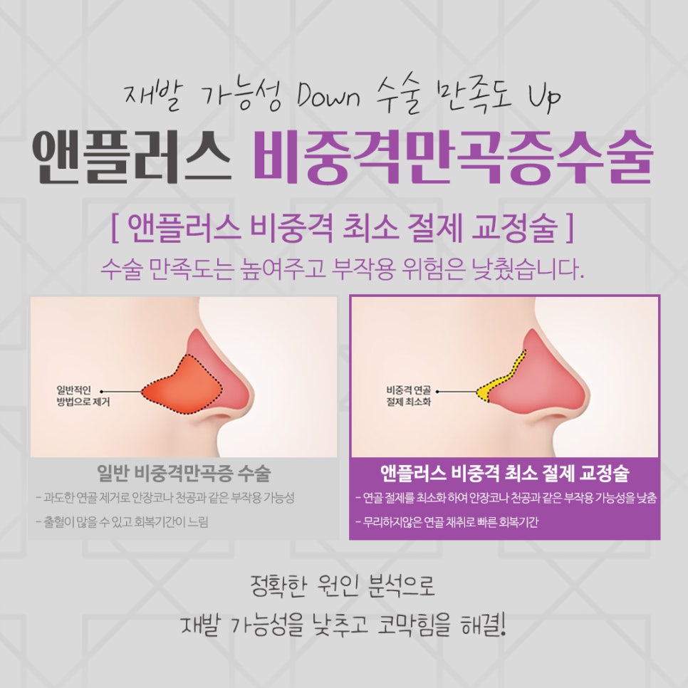 비중격만곡증수술 원인을 자세하게 관련 이미지 9