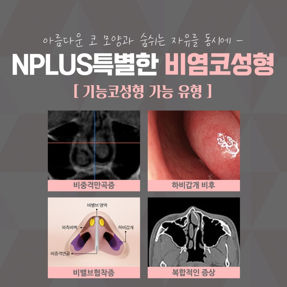 비염의원인 정확하게 진단하여 관련 이미지 4
