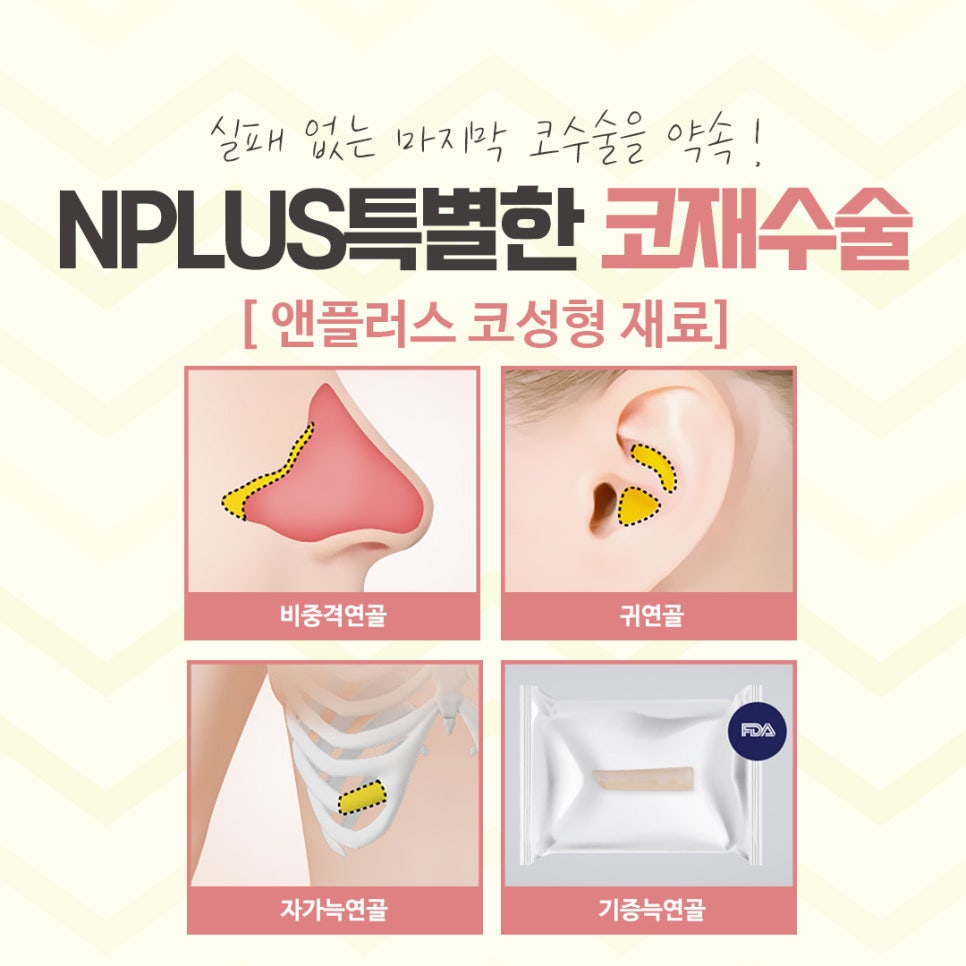 코재수술성형외과 차이를 알아보고 관련 이미지 10