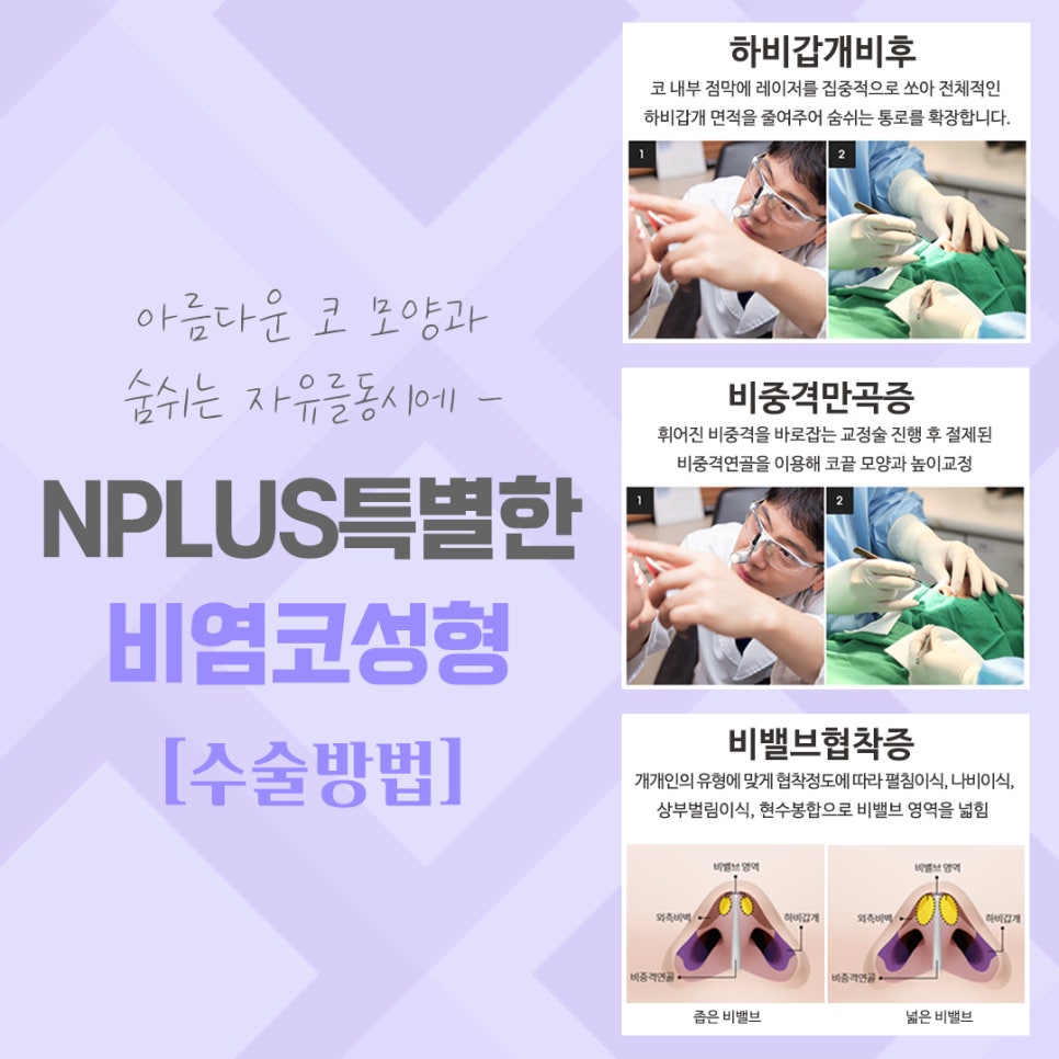Check Exactly Rhinoplasty and Rhinitis Surgery Reviews image 10