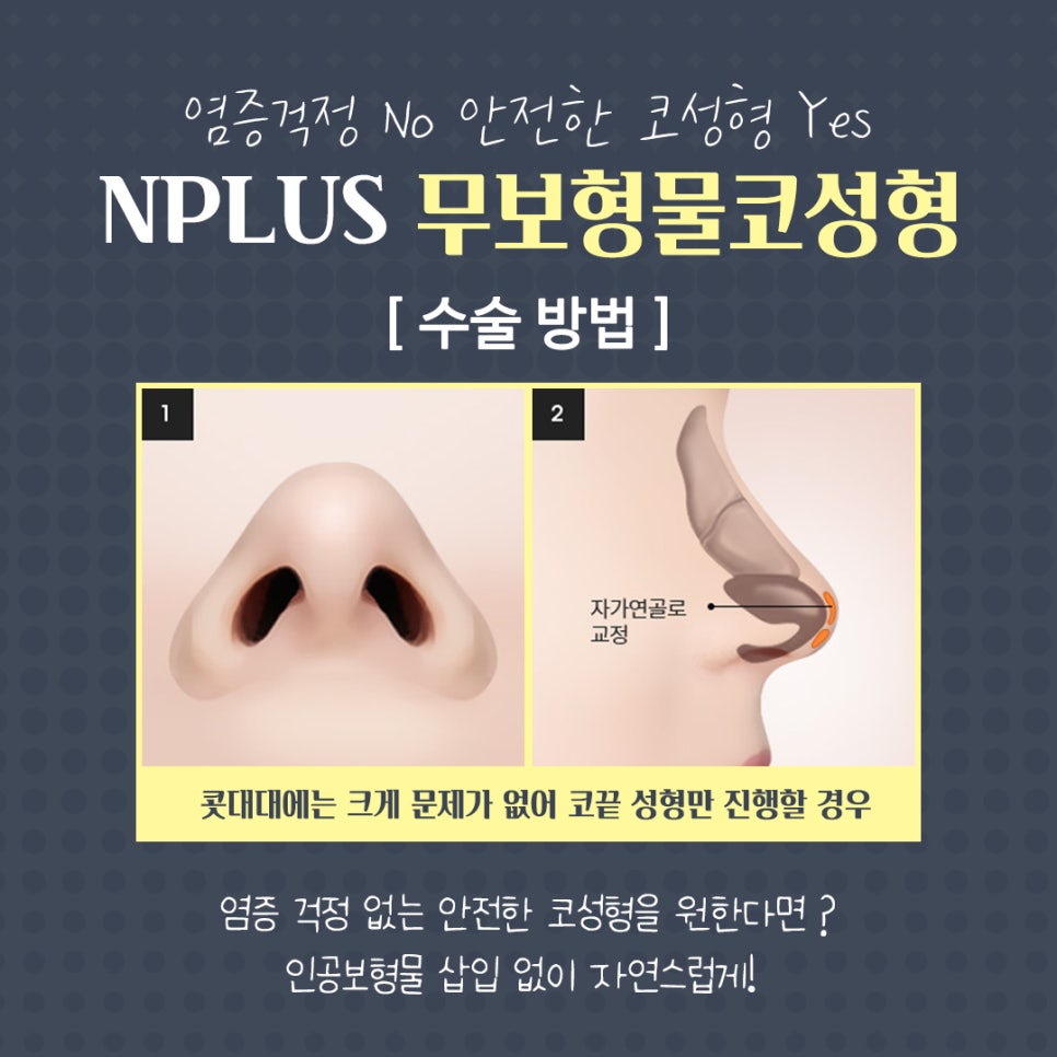 Non-Implant Nose Surgery Using Autologous Cartilage image 10