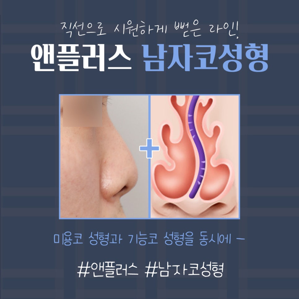 A Sophisticated Image Transformation Before and After Male Nose Surgery image 5
