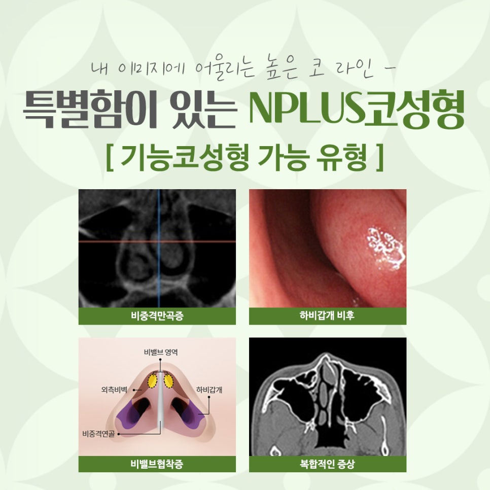코수술잘하는병원을 찾아보고 관련 이미지 5