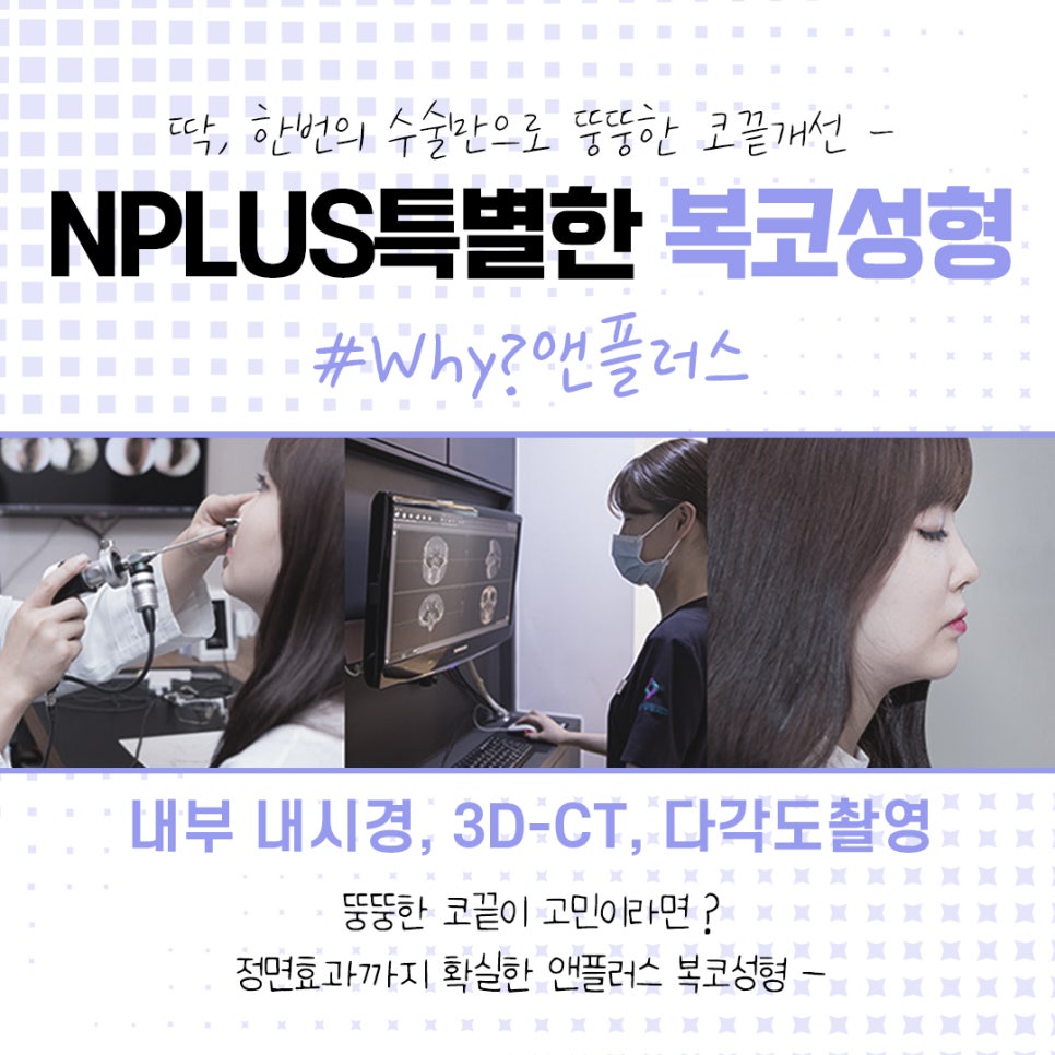 복코수술전후에 대해 자세히 찾아보고 관련 이미지 6
