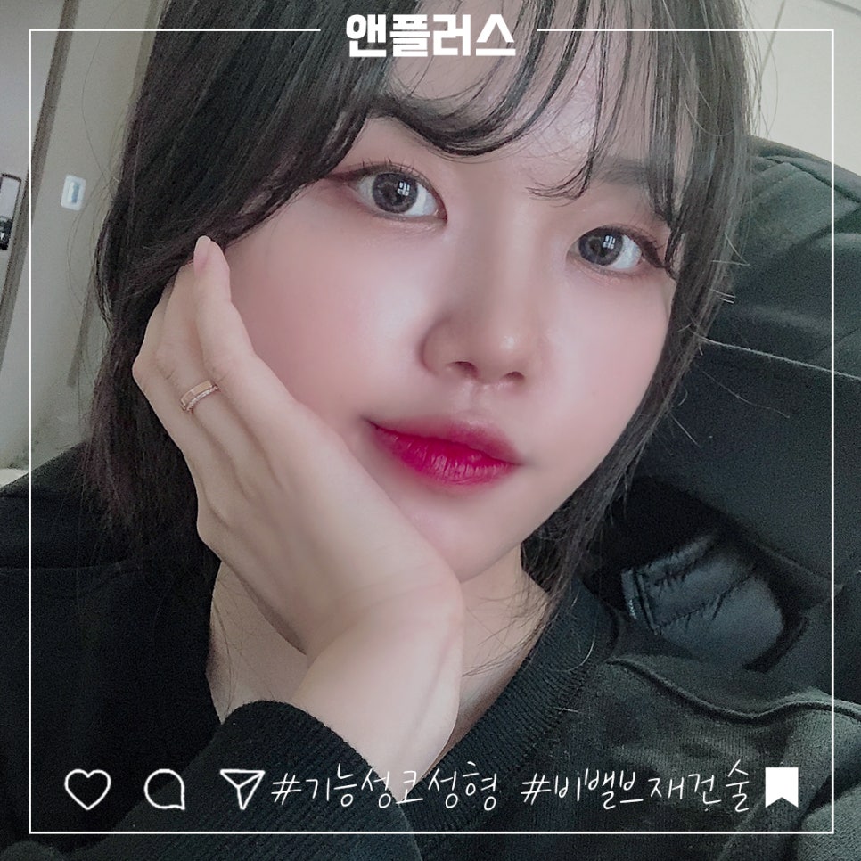 비밸브재건술 확실한 강남앤플러스에서 관련 이미지 1