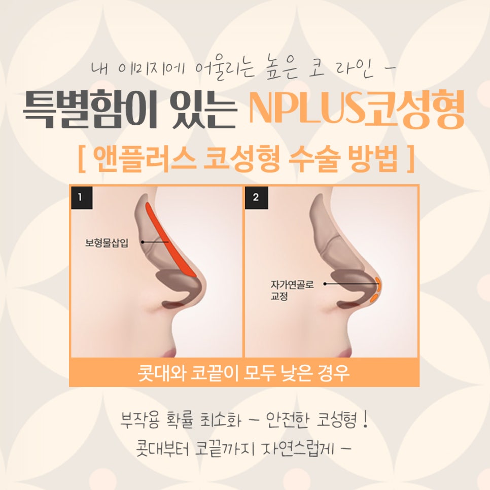 서울성형외과에서 알아본 코수술후기 관련 이미지 8