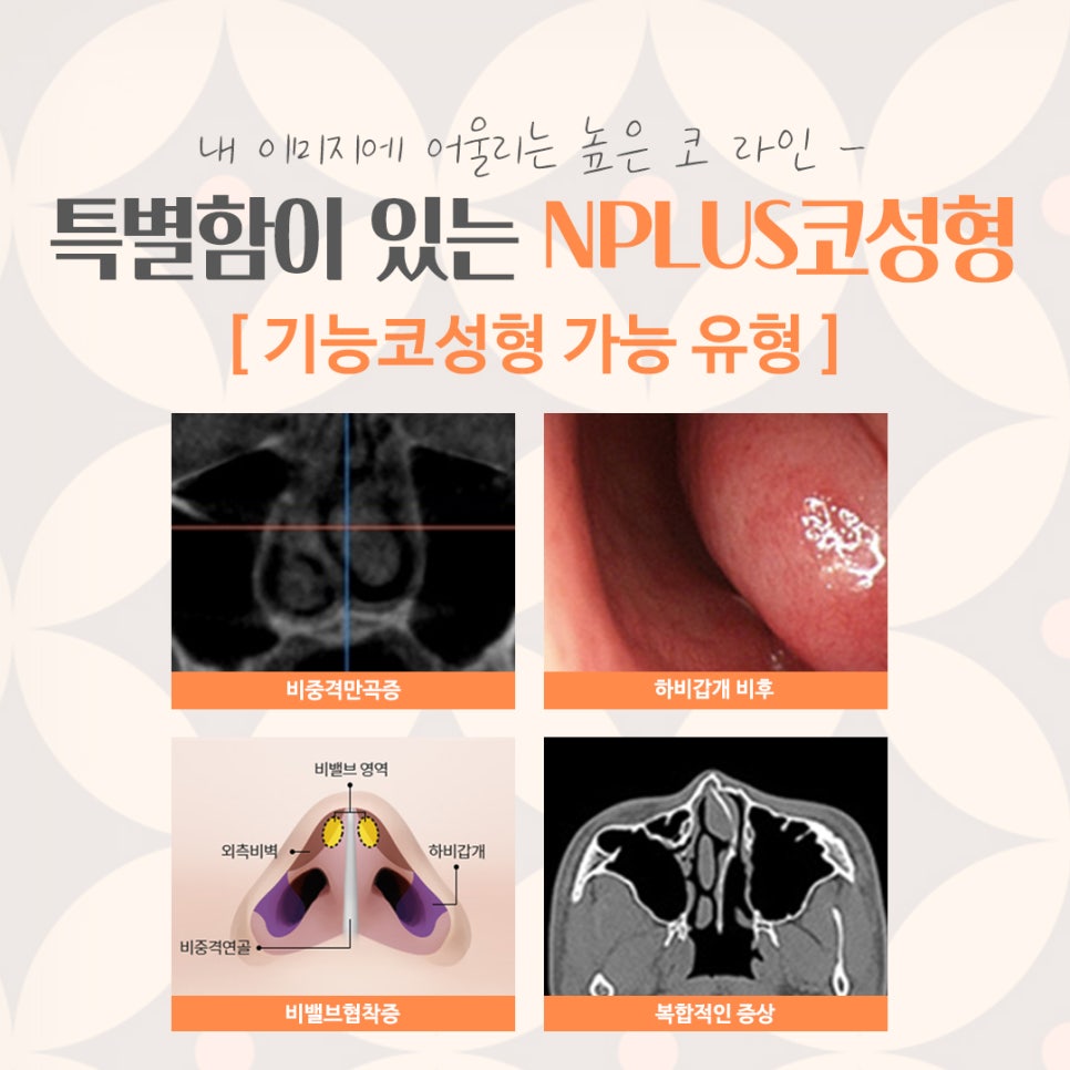 코성형잘하는병원 다양하게 알아보고 관련 이미지 5