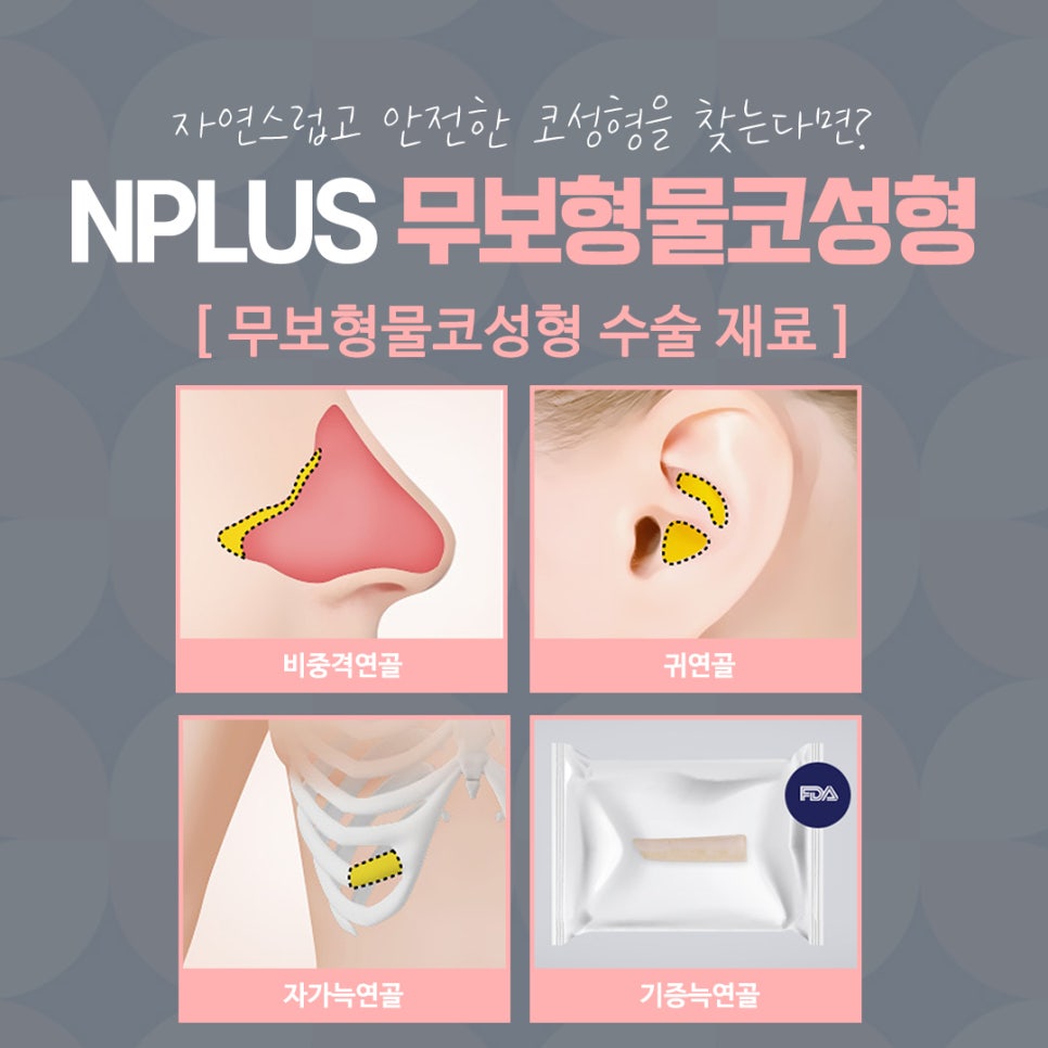 No-Implant Nose Surgery for a Natural Nose Line image 11