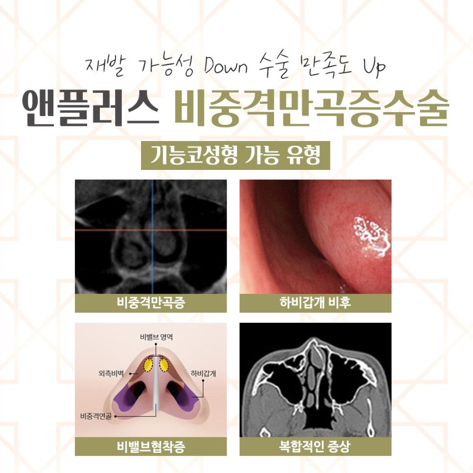 Septoplasty Surgery Review: Accurately Identifying the Cause image 6