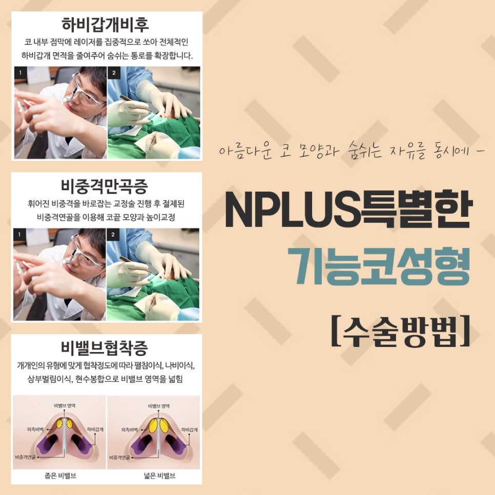 Understanding and Preparing for Functional Rhinoplasty Coverage in Detail image 9