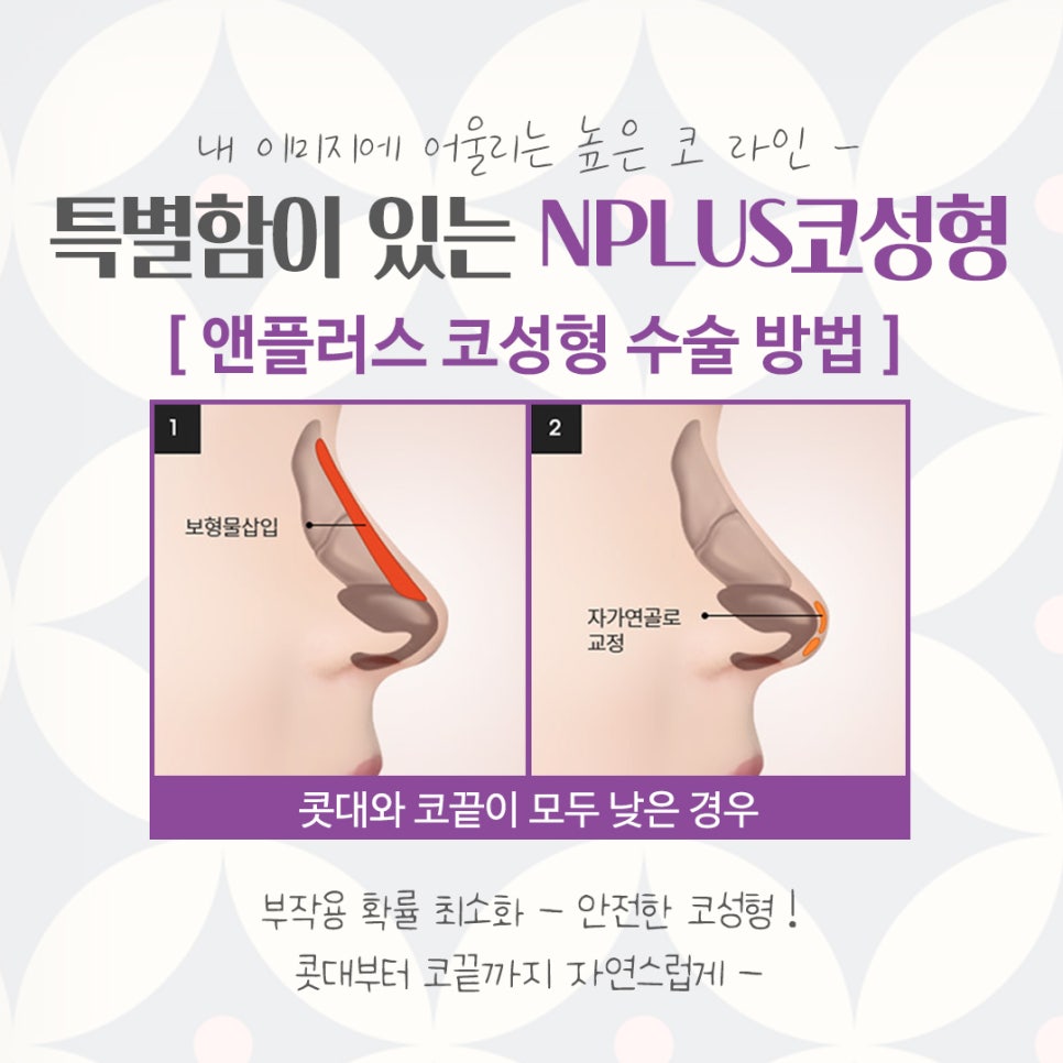 압구정성형외과에서 알려드리는 코수술후기 관련 이미지 8