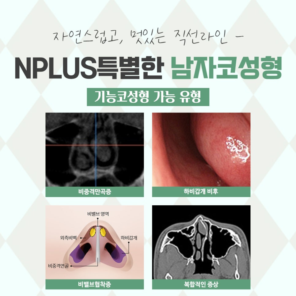 Learn More About Male Rhinoplasty Reviews in Detail image 6