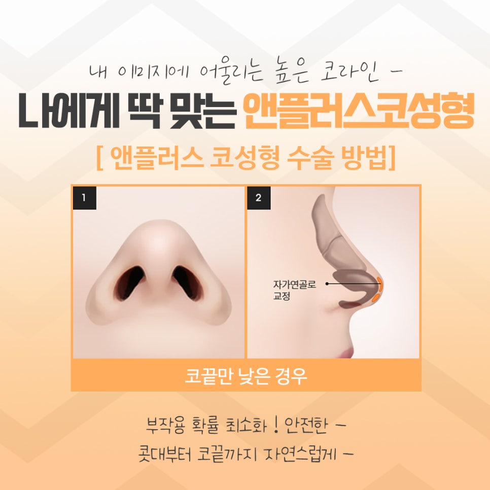 코수술후기에 대해 자세히 찾아보고 관련 이미지 10