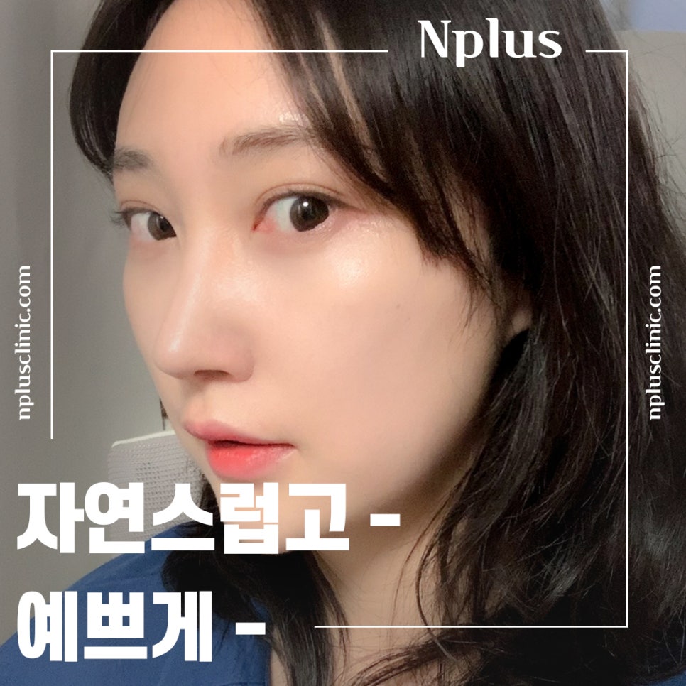 Hump Nose Surgery Review with an Accurate Diagnosis image 14