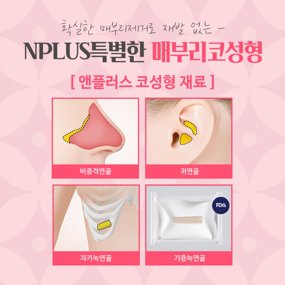 매부리코성형후기 내부까지 확인하고 관련 이미지 12