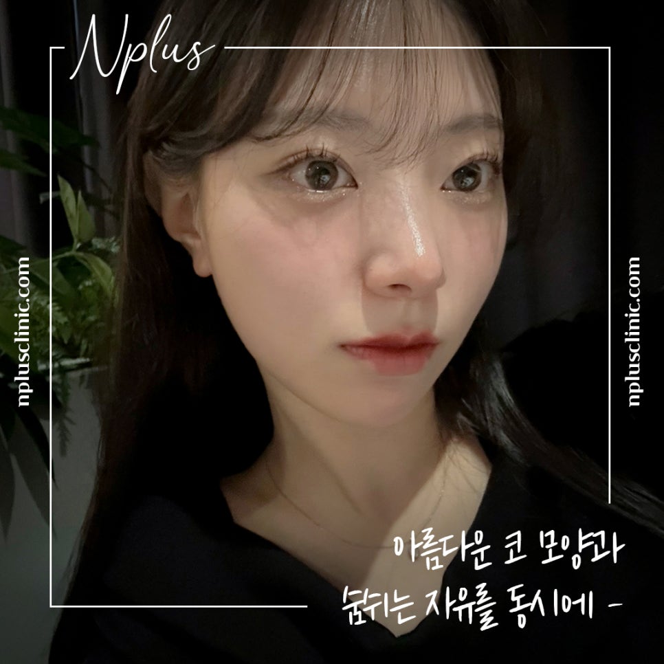화살코수술 자세하게 알아보고 관련 이미지 14