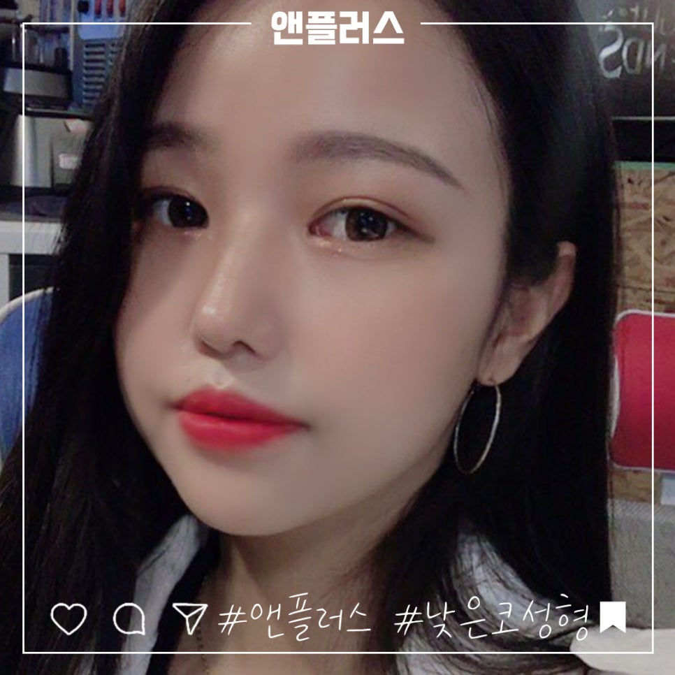 낮은코수술후기 세련된 코라인으로 관련 이미지 4