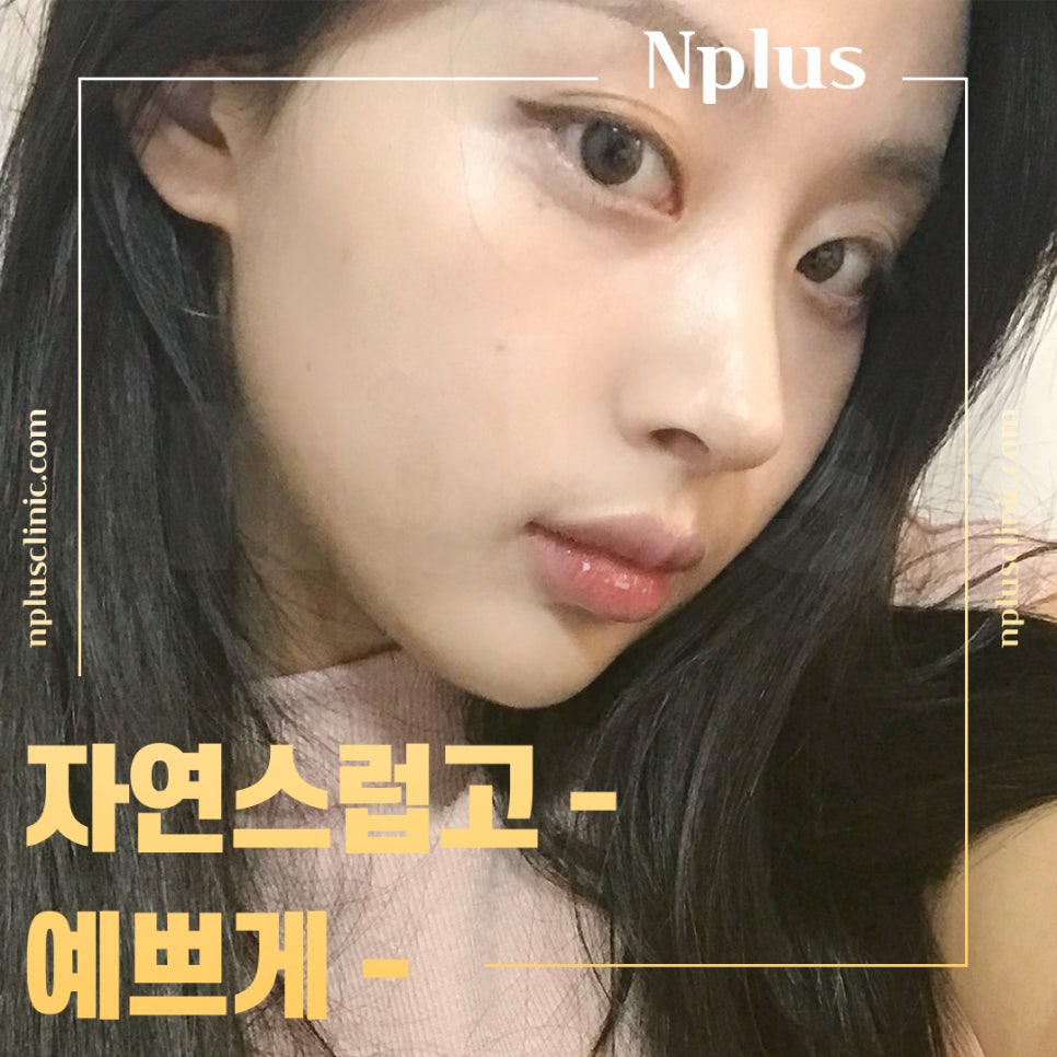 Addressing the Problems of Short Nose Surgery image 12