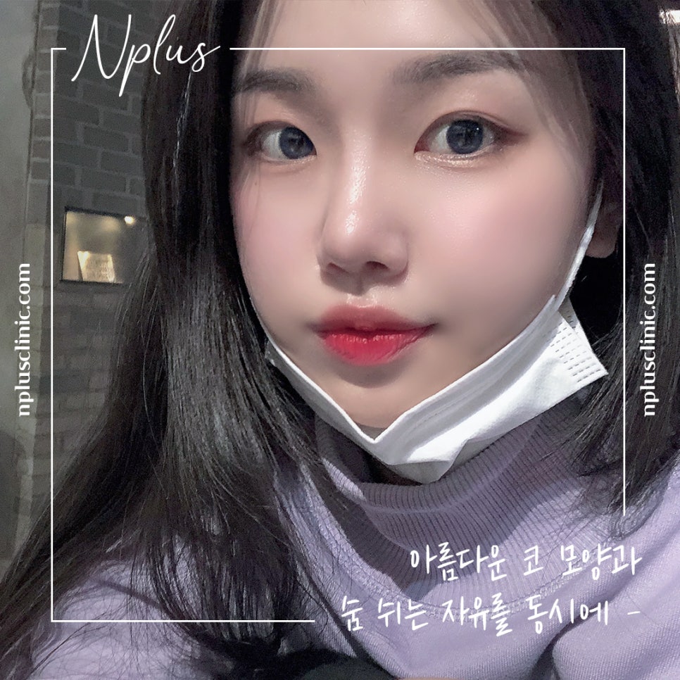 코성형전후 꼼꼼하게 비교하고 결정 관련 이미지 2