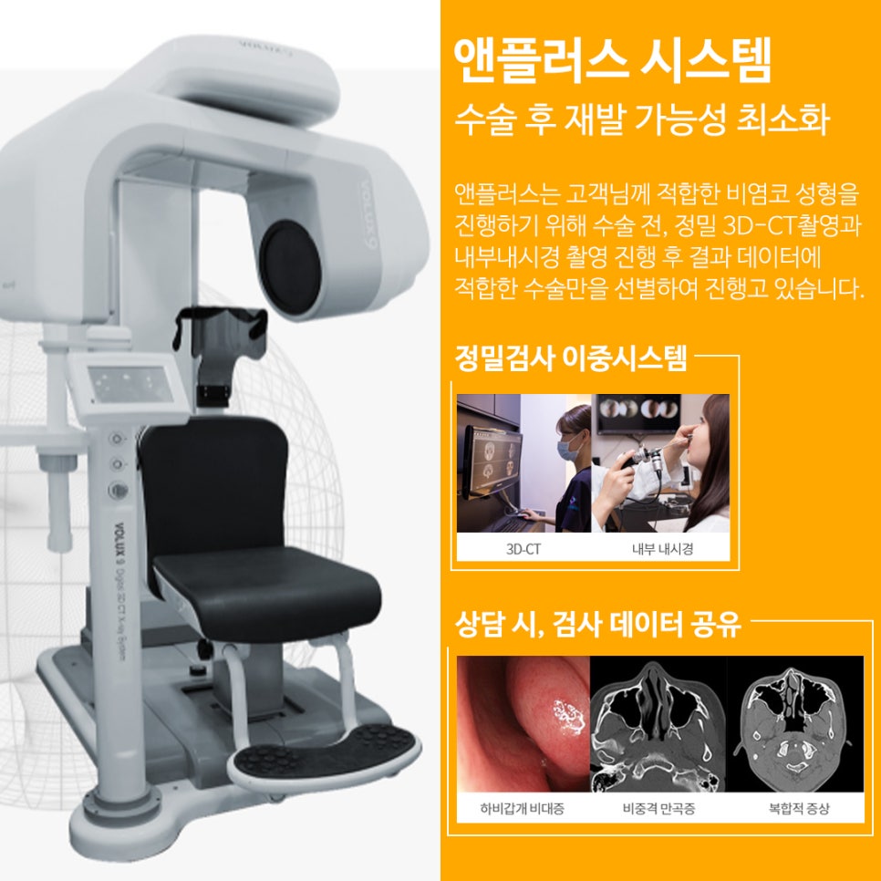 콧대수술_비염기능까지 고려해서 관련 이미지 4