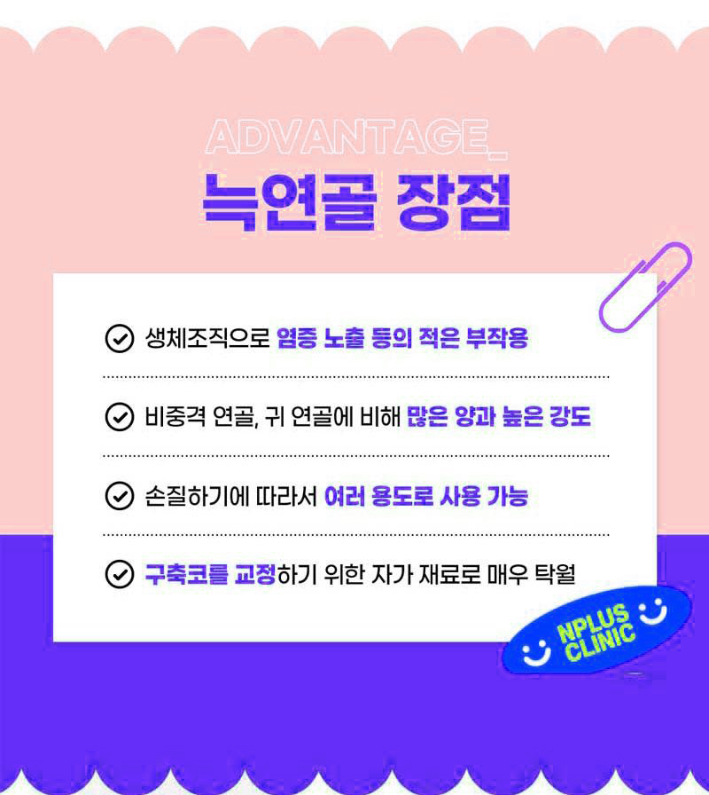 자가늑연골코성형비용에 대해 알아본다면?! 관련 이미지 5