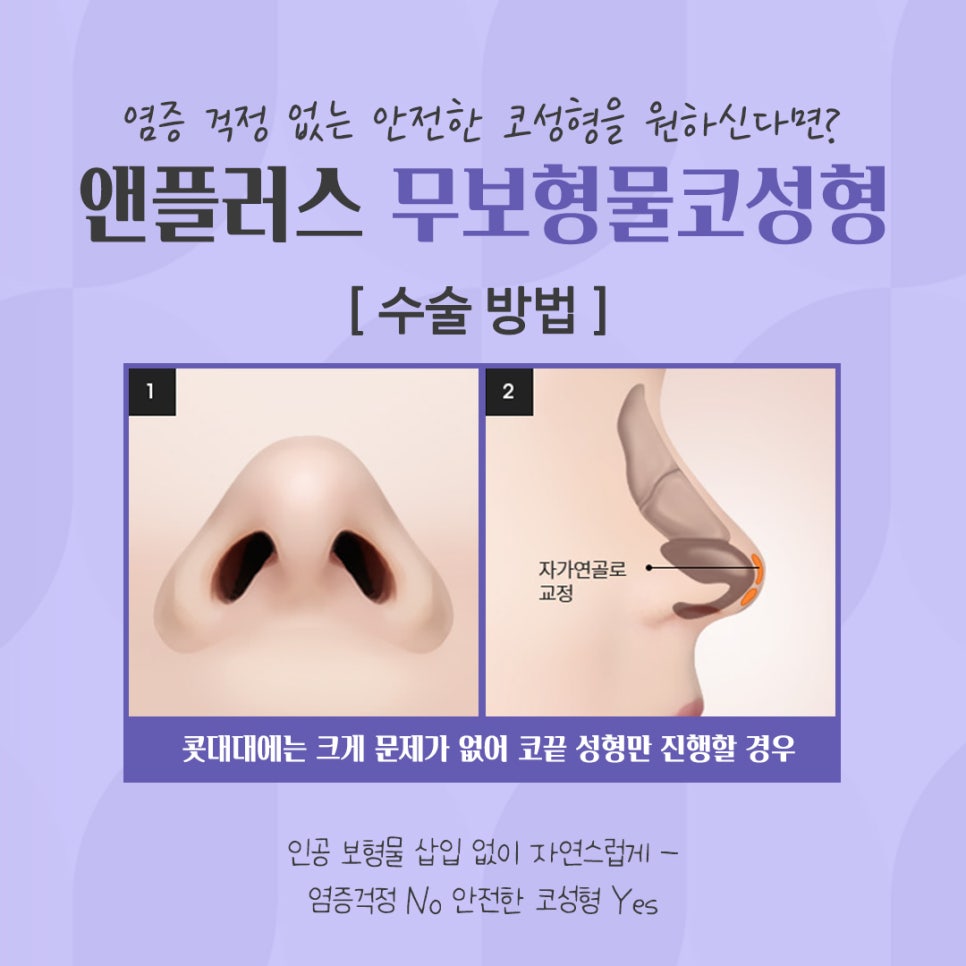 무보형물코성형 자가연골 활용으로 안전하게 관련 이미지 9