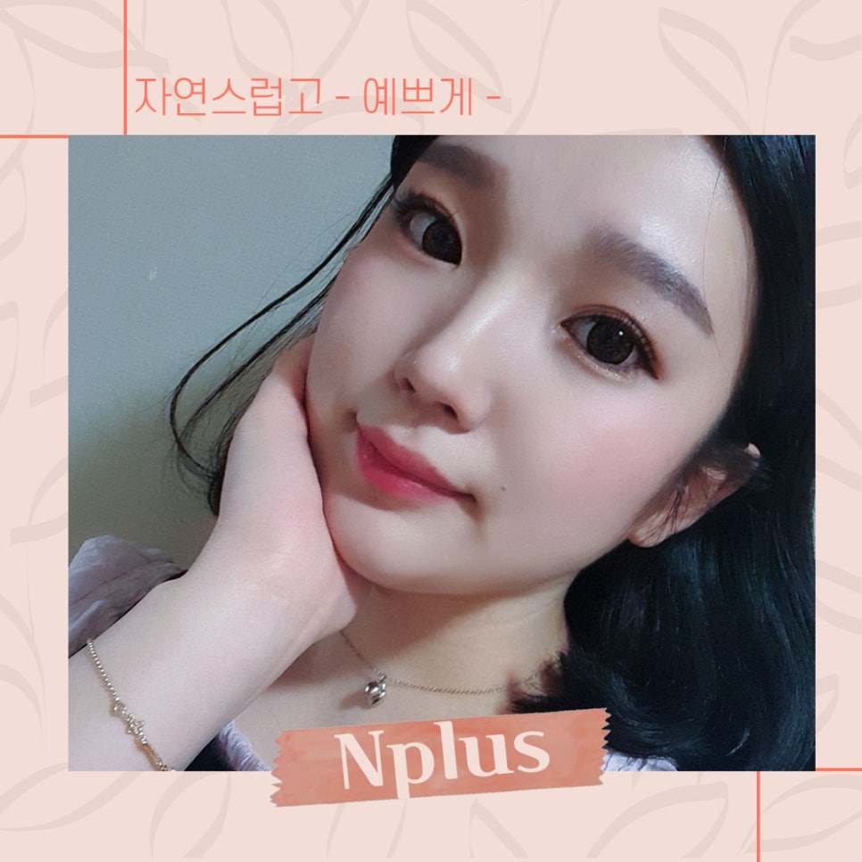 A Review of Nostril Reduction Surgery for a More Refined Look image 2