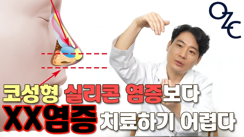 코구축현상이 일어나는 원인과 해결 방법 관련 이미지 2