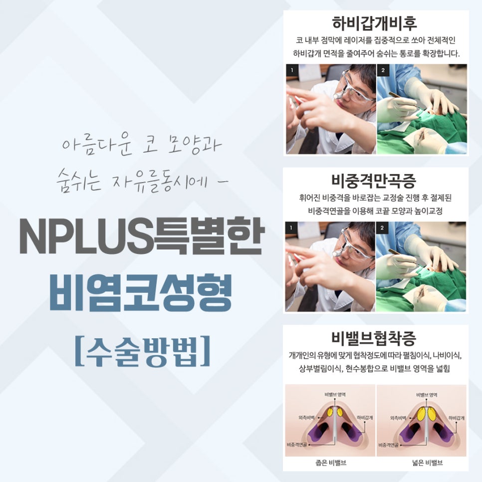 비염코수술후기 자세하게 알아보고 관련 이미지 8