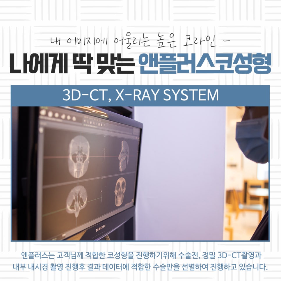 자가연골 이용한 코성형 후기 관련 이미지 6