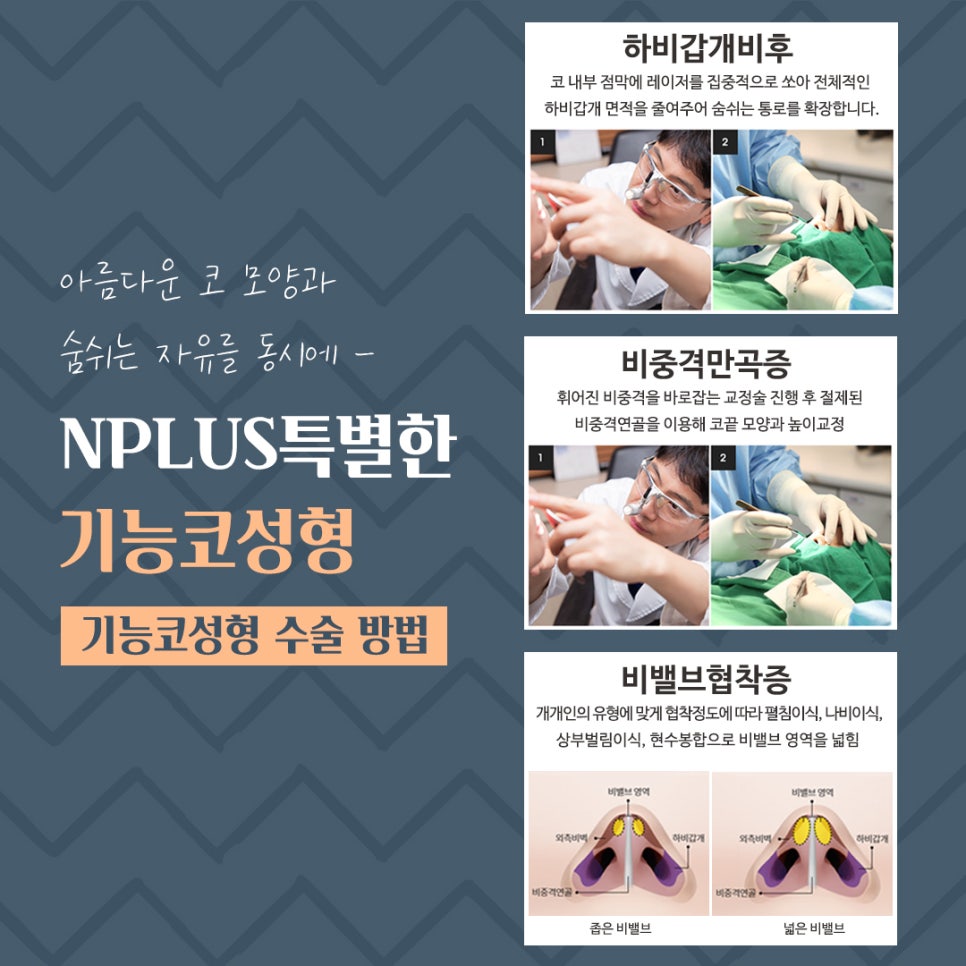 기능코성형후기 정확한 원인 분석으로 관련 이미지 10
