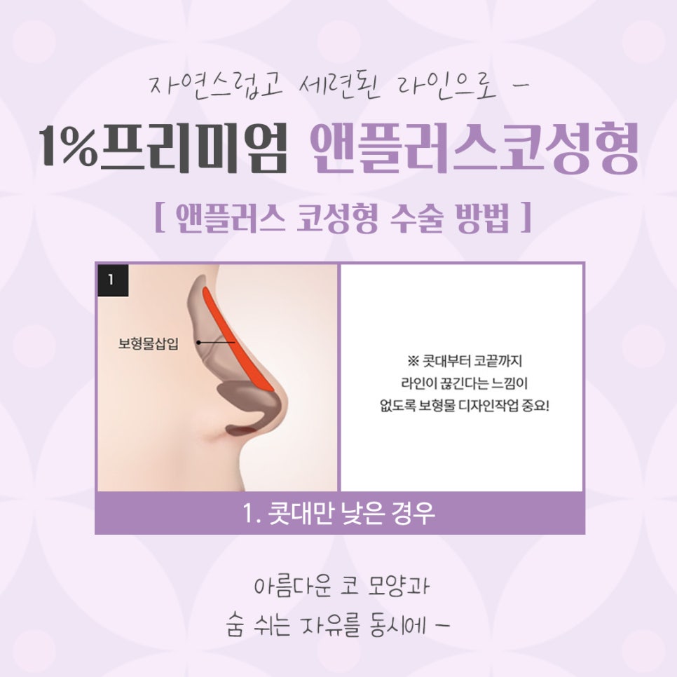 늑연골 코수술 자세하게 알아보고 관련 이미지 8