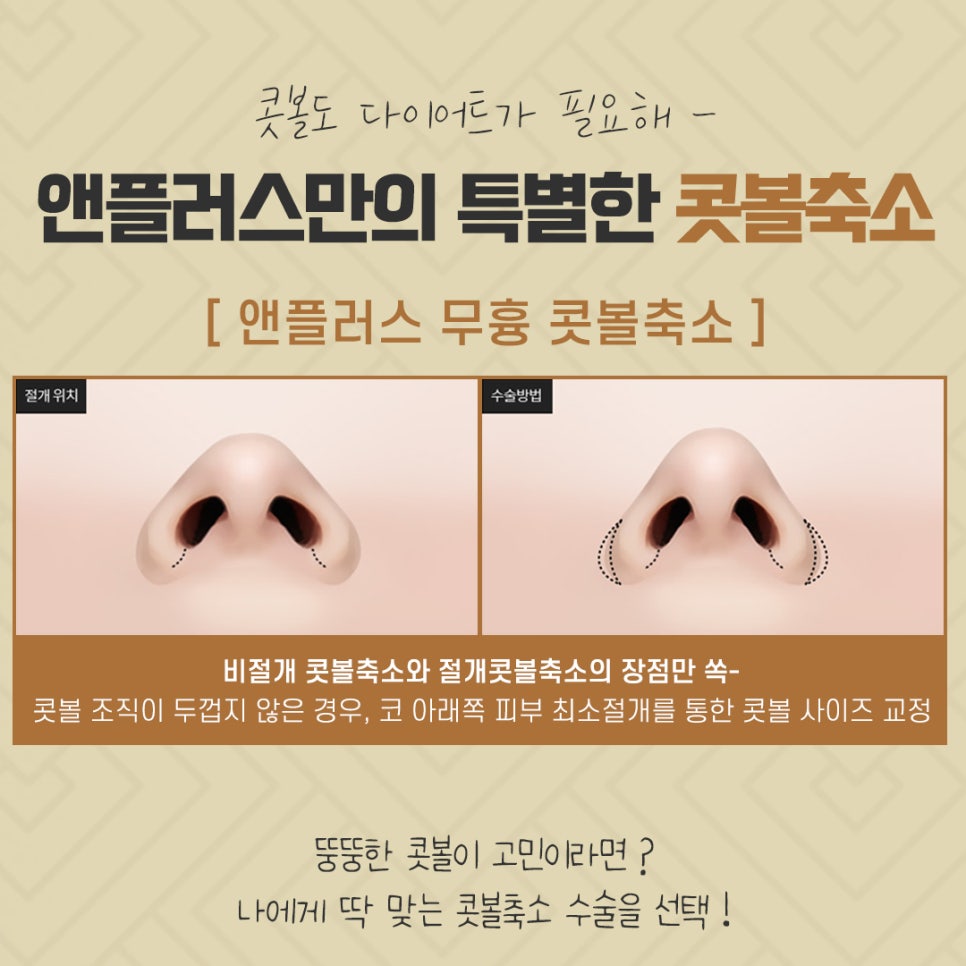 Nasal Ala Reduction Review: Research Carefully Before Deciding image 8