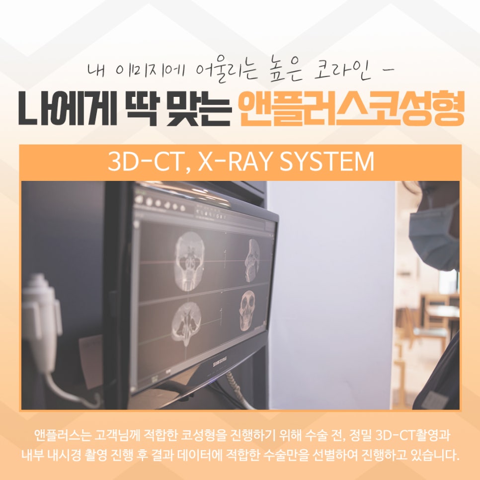 코수술후기에 대해 자세히 찾아보고 관련 이미지 6