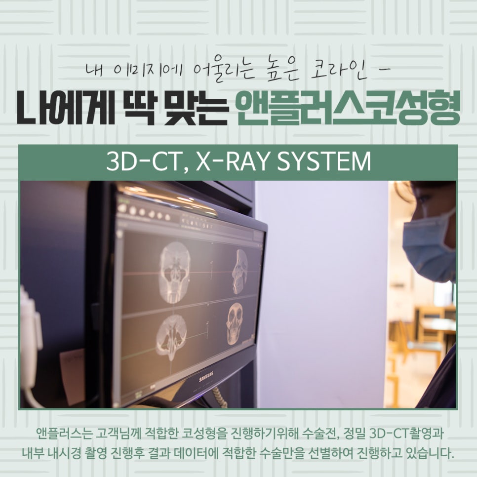 자가연골코수술로 세련되고 자연스럽게 관련 이미지 6
