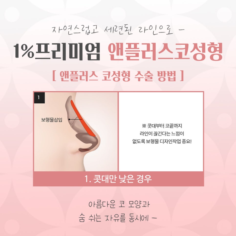 늑연골코수술을 통해 세련된 라인으로 관련 이미지 8