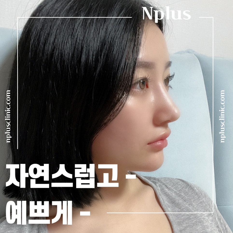 복코성형후기 코지방제거로 확실하게 관련 이미지 2