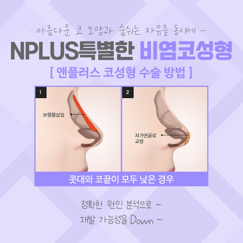 Check Exactly Rhinoplasty and Rhinitis Surgery Reviews image 11