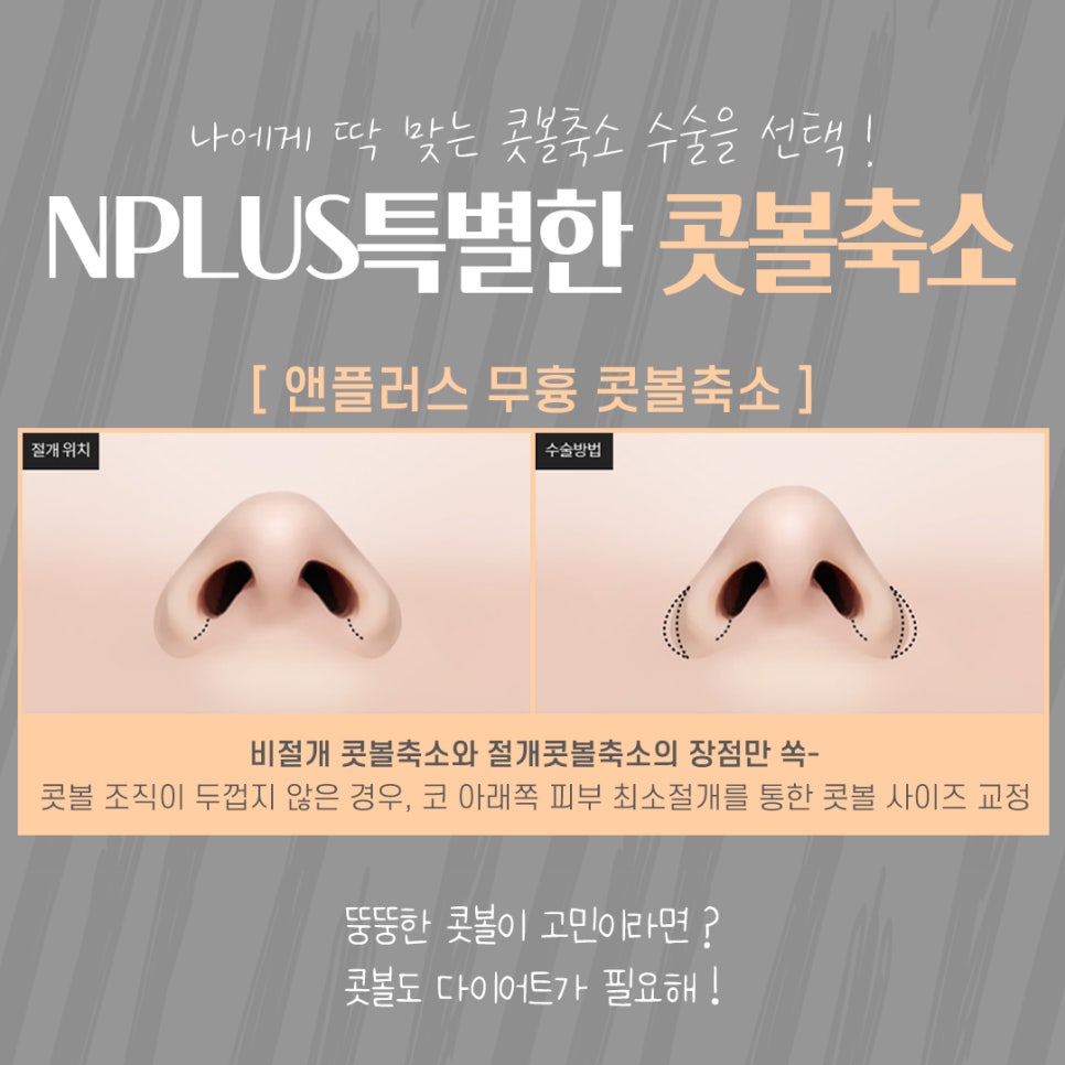 콧볼축소수술후기 내게 어울리는 라인으로 관련 이미지 8